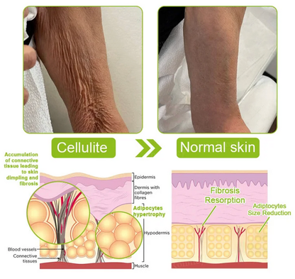 👍 Regain youthful skin nown 💫 VITA A  Wrinkle Lift Tightening Cream