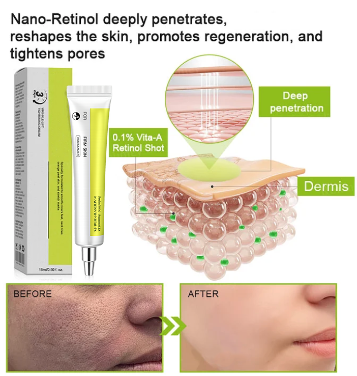 👍 Regain youthful skin nown 💫 VITA A  Wrinkle Lift Tightening Cream