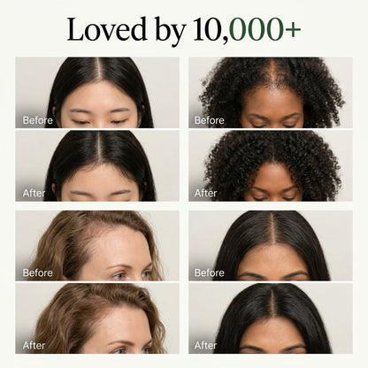 Nature Green™ Botanical Shampoo Bar  A gentle botanical cleanse for a fresher scalp and softer, fuller-looking hair.
